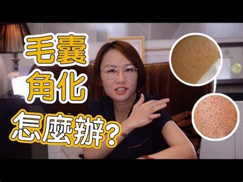 胸部長一根毛|乳頭邊長了毛，是什麼病？該不該拔？讓名醫一次解釋給您聽｜每